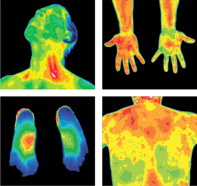 Thermal scan showing human body heat distribution