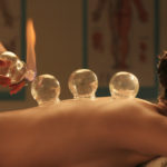 acupuncture-LS_RF_viewstock131000169