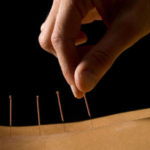 acupuncture_LS_ISP_6209215Hor