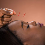 acupuncture_LS_RF_160400956